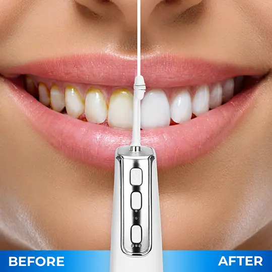 Miracle Smile Magic Flosser 6